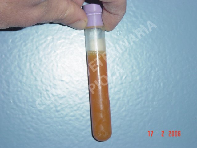 Liquido peritoneale da peritonite settica